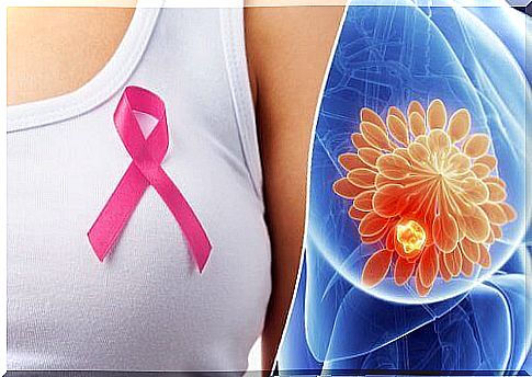 10 Signs That May Indicate Breast Cancer