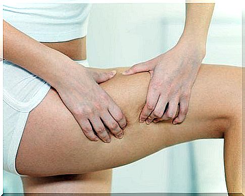 cellulite on the leg