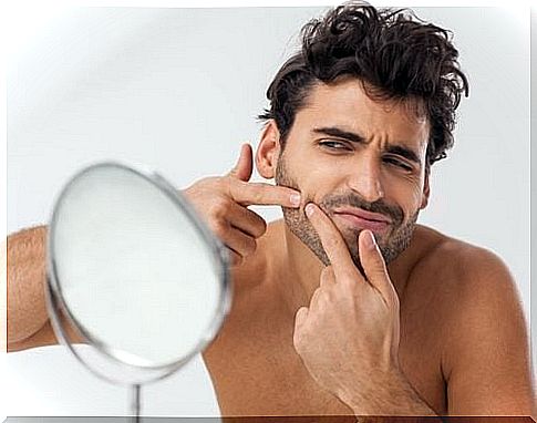 Man squeezing pimple.  This should be avoided using Vick Vaporub