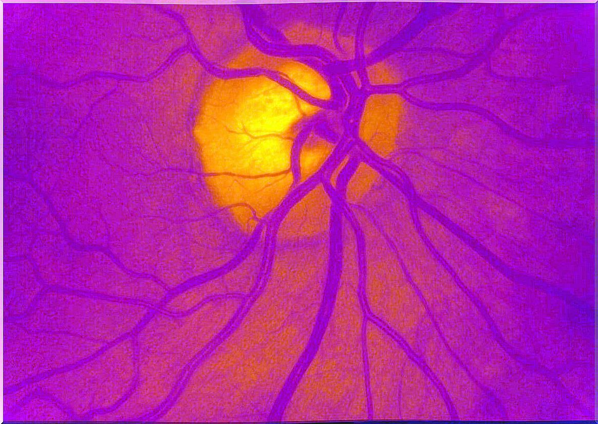 The retina and its blood vessels