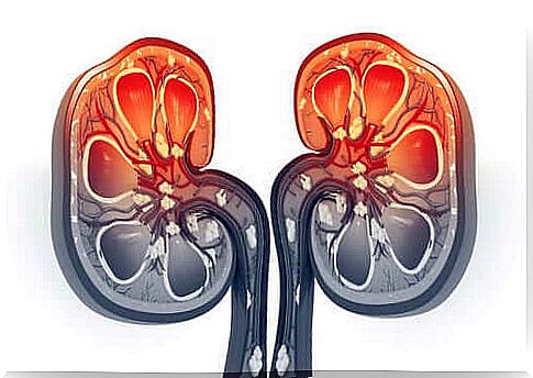 Risk factors for kidney abscess