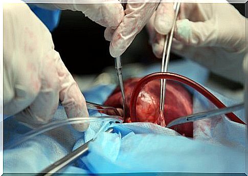 heart operation