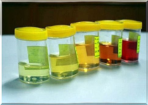 Urine alteration: aspects to be considered