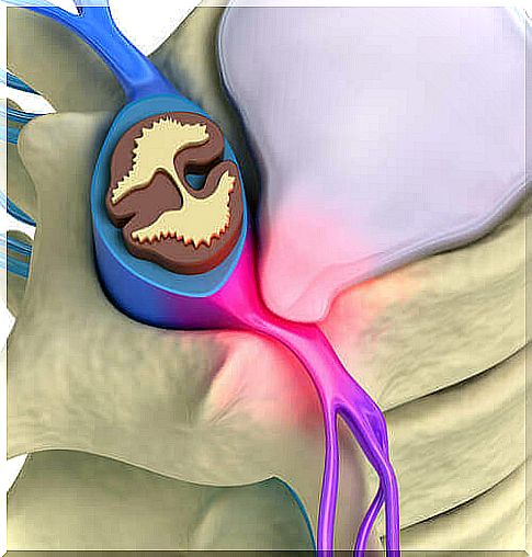 Pain nociceptors